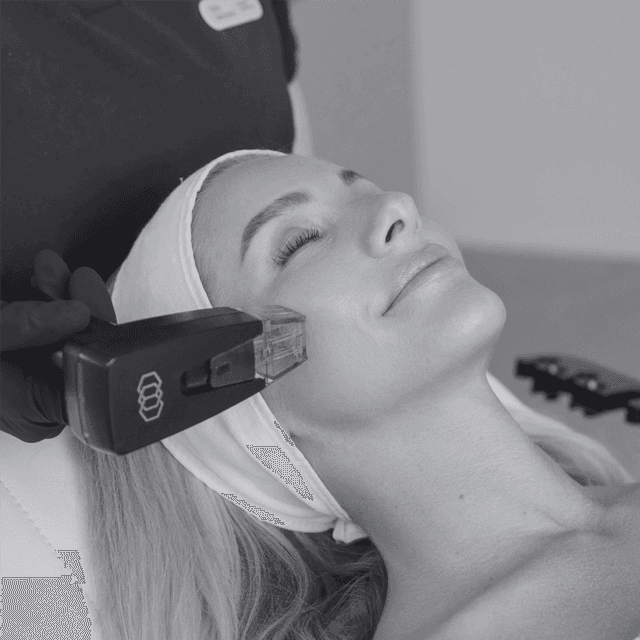Morpheus8 Burst Deep Body Package at Kietre Wellness & Aesthetics in North Las Vegas, NV